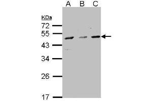 WB Image Sample(30 μg of whole cell lysate) A:293T B:A431, C:H1299 10% SDS PAGE antibody diluted at 1:1500