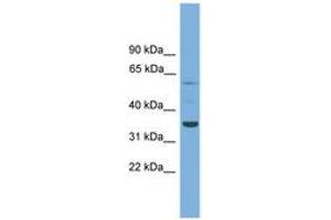 Image no. 1 for anti-Chromosome 3 Open Reading Frame 67 (C3orf67) (AA 71-120) antibody (ABIN6744899) (C3orf67 antibody  (AA 71-120))