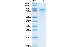 KLKB1 Protein (AA 20-638) (His tag)
