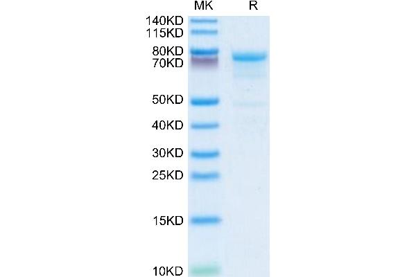 KLKB1 Protein (AA 20-638) (His tag)