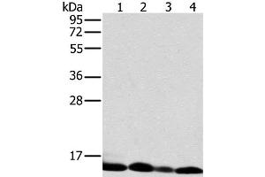 Western Blot analysis of Human liver tissue and K562 cell, Human fetal brain tissue and Raji cell using NDUFS5 Polyclonal Antibody at dilution of 1:400 (NDUFS5 antibody)