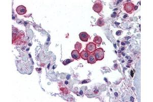 IHC-P Image Immunohistochemical analysis of paraffin-embedded human lung, using VRL1, antibody(10 μg/ml). (TRPV2 antibody  (C-Term))