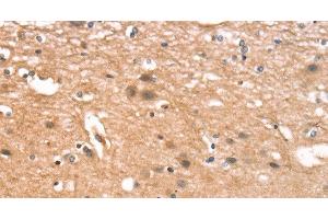 Immunohistochemistry of paraffin-embedded Human brain tissue using CYLD Polyclonal Antibody at dilution 1:35 (CYLD antibody)