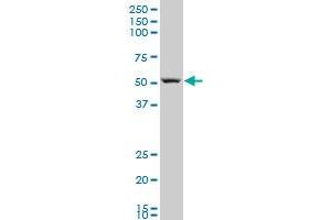 ARHGAP1 polyclonal antibody (A01), Lot # ABNOVA060629QCS1 Western Blot analysis of ARHGAP1 expression in MES-SA/Dx5 . (ARHGAP1 antibody  (AA 340-439))