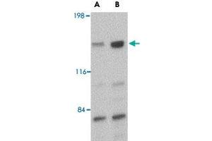 Western blot analysis of CADPS in rat brain tissue lysate with CADPS polyclonal antibody  at (A) 0.