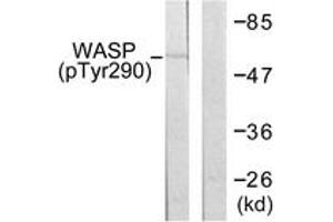 Western blot analysis of extracts from HepG2 cells, using WASP (Phospho-Tyr290) Antibody. (WASP antibody  (pTyr290))