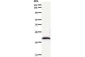 Western Blotting (WB) image for anti-TBP-Associated Factor 172 (BTAF1) antibody (ABIN933089) (BTAF1 antibody)