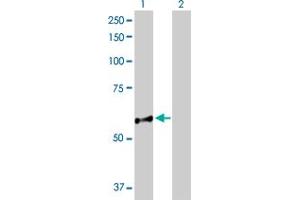 Western Blot analysis of NUP98 expression in transfected 293T cell line by NUP98 MaxPab polyclonal antibody. (NUP98 antibody  (AA 1-606))