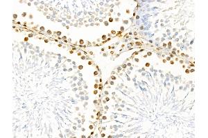 ABIN6261411 and ABIN6266531 at 1/100 staining Rat testis tissue by IHC-P. (E2F4 antibody  (N-Term))