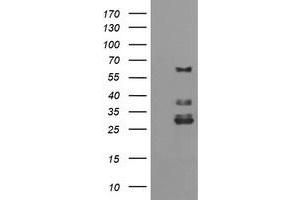 Image no. 1 for anti-Tripartite Motif Containing 45 (TRIM45) (AA 288-580) antibody (ABIN1491334)
