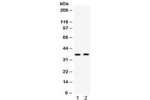 Western blot testing of 1) rat kidney and 2) human HepG2 lysate with Fos B antibody. (FOSB antibody)