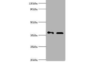 Western blot All lanes: Aldo-keto reductase family 1 member C4 antibody at 7 μg/mL Lane 1: Hela whole cell lysate Lane 2: HepG 2 whole cell lysate Secondary Goat polyclonal to rabbit IgG at 1/10000 dilution Predicted band size: 37 kDa Observed band size: 37 kDa