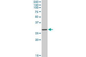MAGEA12 monoclonal antibody (M01), clone 3A10. (MAGEA12 antibody  (AA 70-168))