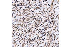 IHC analysis of SSRP1 using anti-SSRP1 antibody (ABIN7600496). (SSRP1 antibody  (AA 2-381))