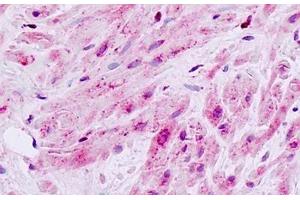 Human, Prostate, smooth muscle: Formalin-Fixed Paraffin-Embedded (FFPE) (MAP3K9 antibody  (Internal Region))
