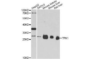 Western blot analysis of extracts of various cell lines, using TPK1 antibody. (TPK1 antibody  (AA 1-243))