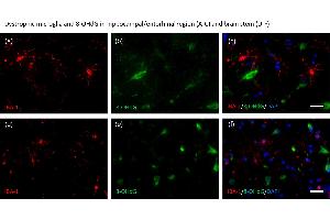 Aged human brain tissue samples of individuals with morphologically dystrophic (a–f) and microglia were stained with an anti-IBA-1 antibody (red: a, d), anti-8-OHdG antibody (green: b, e), and DAPI (blue). (8-OHDG antibody)