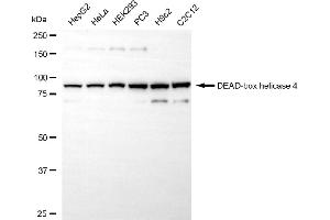 Western blotting analysis using DEAD-box helicase 4 antibody (ABIN7798293).