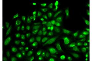 Immunofluorescence analysis of HeLa cell using SPHK1 antibody. (SPHK1 antibody  (AA 50-384))