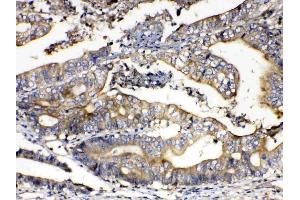 IHC analysis of Calpain 2 using anti-Calpain 2 antibody . (Calpain 2 antibody  (AA 500-700))