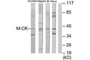 Western Blotting (WB) image for anti-Creatine Kinase, Muscle (CKM) (N-Term) antibody (ABIN1849112)