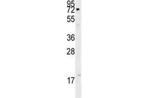 XRCC1 antibody western blot analysis in A375 lysate. (XRCC1 antibody  (AA 407-435))