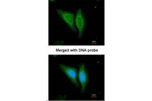 Immunofluorescence (IF) image for anti-Epidermal Growth Factor Receptor (EGFR) (N-Term) antibody (ABIN2854848)