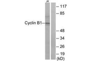 Western blot analysis of extracts from Jurkat cells, treated with UV 15', using Cyclin B1 (Ab-147) Antibody. (Cyclin B1 antibody  (AA 121-170))