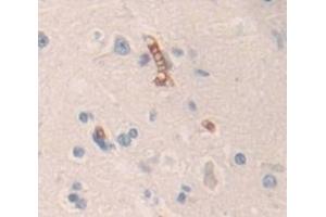 Used in DAB staining on fromalin fixed paraffin- embedded Kidney tissue (Contactin 6 antibody  (AA 658-907))
