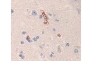 Used in DAB staining on fromalin fixed paraffin- embedded Kidney tissue (Contactin 6 antibody  (AA 658-907))