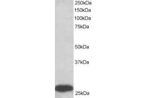 Western Blotting (WB) image for anti-phosphoglycerate Mutase 1 (Brain) (PGAM1) (C-Term) antibody (ABIN2466100)