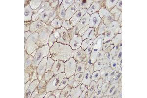 Immunohistochemistry (IHC) image for anti-Transient Receptor Potential Cation Channel, Subfamily C, Member 6 (TRPC6) (AA 500-600) antibody (ABIN6149580)