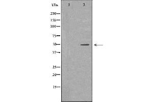 Western blot analysis of Hepg2 whole cell lysates, using KIR3DL1 Antibody. (KIR3DL1 antibody  (Internal Region))