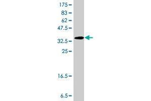 Western Blot detection against Immunogen (37. (AADAT antibody  (AA 326-425))