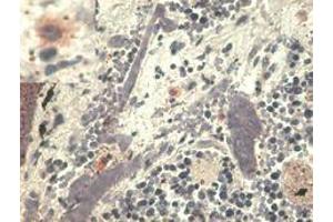 Immunohistochemistry staining with anti-human HLA-G (MEM-G/1). (HLAG antibody)