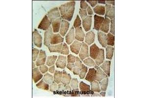 STX7 Antibody (N-term) (ABIN1881855 and ABIN2840425) immunohistochemistry analysis in formalin fixed and paraffin embedded human skeletal muscle followed by peroxidase conjugation of the secondary antibody and DAB staining. (Syntaxin 7 antibody  (N-Term))