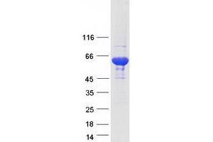 Western Blotting (WB) image for EH-Domain Containing 1 (EHD1) protein (Myc-DYKDDDDK Tag) (ABIN2720034)