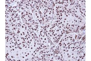 IHC-P Image Immunohistochemical analysis of paraffin-embedded Cal27 Xenograft, using Apoptosis-enhancing nuclease, antibody at 1:100 dilution. (AEN antibody  (C-Term))