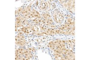 Immunohistochemistry of paraffin-embedded rat ovary using TAZ Rabbit pAb (ABIN6130800, ABIN6150278, ABIN6150279 and ABIN6224227) at dilution of 1:50 (40x lens).