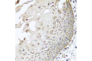 Immunohistochemistry of paraffin-embedded human esophagus using IRS2 antibody (ABIN5974770) at dilution of 1/100 (40x lens). (IRS2 antibody)