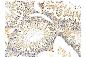 ABIN6258050 and ABIN6274634 at 1/100 staining Rat testis tissue by IHC-P.