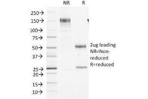 SDS-PAGE Analysis of Purified, BSA-Free Factor XIIIa Antibody (clone F13A1/1448).