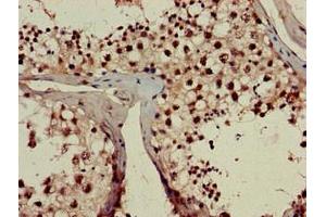 Immunohistochemistry of paraffin-embedded human testis tissue using ABIN7142772 at dilution of 1:100 (RPL23A antibody  (AA 1-92))