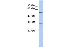 WB Suggested Anti-RELB Antibody Titration:  0. (RELB antibody  (Middle Region))