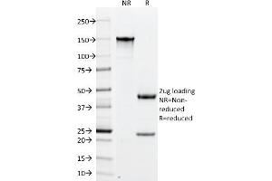 SDS-PAGE Analysis Purified PLGF Monoclonal Antibody (PLGF/94).