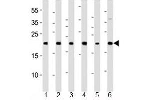 Western blot analysis of lysate from 1) HeLa, 2) 293, 3) HT-1080, 4) Raji, 5) SH-SY5Y and 6) THP-1 cell line using BAX antibody at 1:1000.