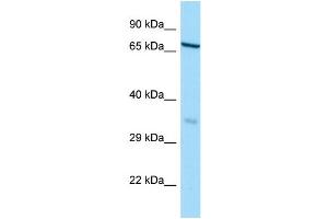 WB Suggested Anti-HAUS3 Antibody Titration: 1. (HAUS3 antibody  (N-Term))