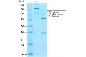 SDS-PAGE Analysis Purified p21 Rabbit Recombinant Monoclonal Antibody (CIP1/2275R). (Recombinant p21 antibody)