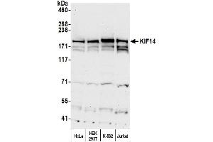 Western Blotting (WB) image for anti-Kinesin Family Member 14 (KIF14) (C-Term) antibody (ABIN7455214)