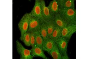IF analysis of FEN1 using anti-FEN1 antibody (ABIN7601617) and anti-Beta Tubulin antibody (ABIN7602743).